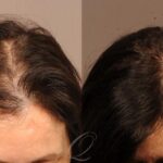 fut-1121-view-1-thumbnail.jpg