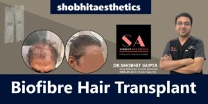 Expert Hair Transplant in Delhi: Restore your Confidence Today