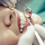 Dental-Fillings-Aldgate-Dental-Care-London-UK.jpg