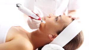 How to Achieve Smoother Skin with Microneedling: A Treatment Guide in Islamabad