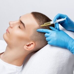 Does PRP Help with Hair Regrowth in Islamabad?