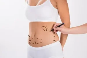 Transform Your Midsection with a Tummy Tuck in Riyadh