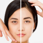 dark-circles-treatment-in-islamabad.jpg