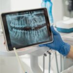Dental-Panoramic-X-Ray-25.jpg