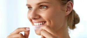 Teeth Whitening Strips in Riyadh: Side Effects & Precautions