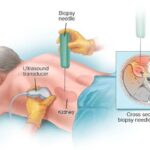 biopsy-for-diagnostic-purposes-7.jpg