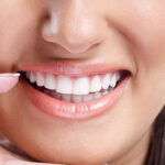 Porcelain-crowns-1.jpg