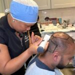 SmartGraft-Hair-Restoration.jpg