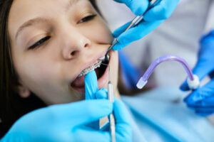 How to Maintain Results After Teeth Cleaning in Riyadh