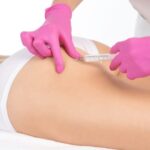 The-Benefits-of-Butt-Fillers-Over-Surgery.jpg