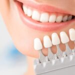 teeth-whitening-hero-1536x550.jpg