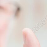 Gastrointestinal-Stent.jpg