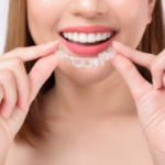 Boca-Raton-Invisible-Braces.png