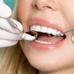 Dental-Veneers-2.jpg