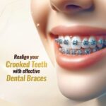 Dental-braces-in-islamabad.-1.jpg