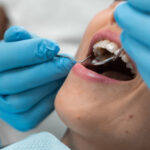Dentist-in-Riyadh-19.jpg