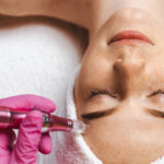 Derma-pen-14.jpg
