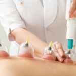 Hijama-and-Healthy-Living-A-Holistic-Combo.png