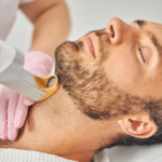 How-Beard-Laser-Hair-Removal-Works.png