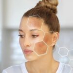 Melasma-Treatment-in-Islamabad.jpg
