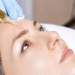 Microneedling-in-Islamabad.jpg
