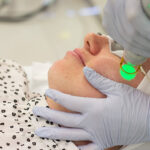 Reclaim-Clear-Skin-with-Professional-Melasma-Treatments.jpg