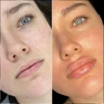 filler-1.webp