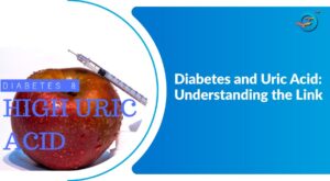 Diabetes & Uric Acid: Symptoms, Causes and Treatment