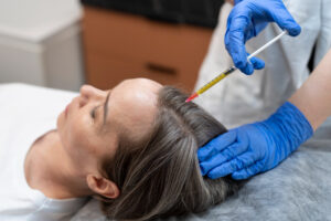 Hair Pulling Trichotillomania Treatment: Effective Strategies and Options Explained