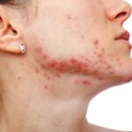 Can-Wearing-Abayas-or-Tight-Clothing-in-Dubai-Cause-Skin-Issues.jpg