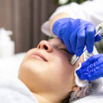 Derma-Pen-1.jpg