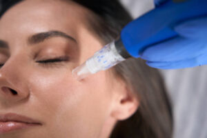 Brighten Your Look with Derma Pen