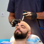 Hair-Loss-Treatement-18.jpg