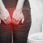 Hemorrhoid-Treatement-in-Riyadh-8.jpg