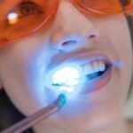 How-Zoom-Teeth-Whitening-Can-Boost-Your-Confidence.jpg