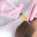 Is-PRP-Hair-Treatment-Covered-by-Insurance.jpg