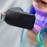 Is-Zoom-Teeth-Whitening-Safe-for-Sensitive-Teeth.jpg