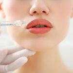 Lip-fillers-in-Riyadh.jpg