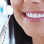 Professional-vs.-DIY-Teeth-Whitening_-Which-is-Right-for-You.jpeg