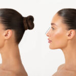 Rhinoplasty-Surgery-in-Riyadh-24.jpg