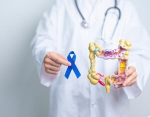 Innovative Approaches: Exploring Hyperthermia Colon Cancer Therapy
