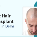 best-hair-transplant-clinic-in-delhi.png