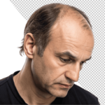 gloomy-depressed-bald-middleaged-1.png