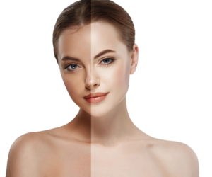Cold Peel Facial: Step-by-Step Guide