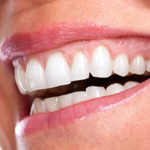 What Influences Full Mouth Reconstruction Cost? A Detailed Breakdown for Informed Patients