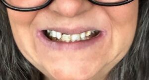 North York Cosmetic Dentist | Glenoakdental.ca