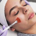 Chemical-Peel-3-scaled.jpg