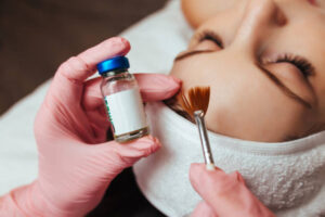 Chemical Peels for Dark Spots Riyadh
