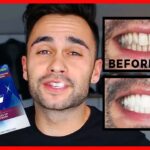 Crest-Teeth-Whitening-Strips.jpg