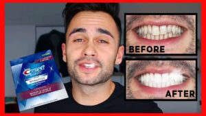 Crest Professional Effects Luxe Whitestrips – Advanced Whitening with The White Smiles